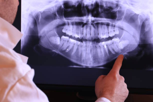Best Emergency Broken Tooth Repair in West Odessa, TX